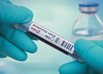 Monkeypox virus test positive